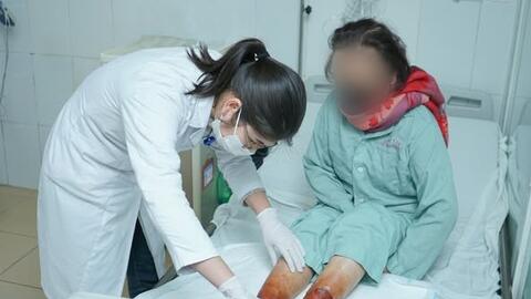 Ngâm chân bột lá khiến hai bàn chân phồng rộp bọng nước, mẩn ngứa