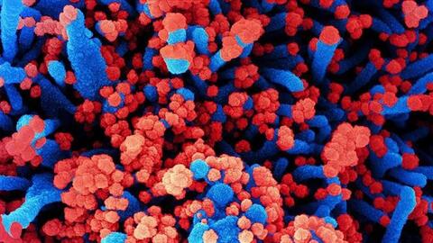 Thông tin về các trường hợp mắc bệnh chưa rõ nguyên nhân tại Nga