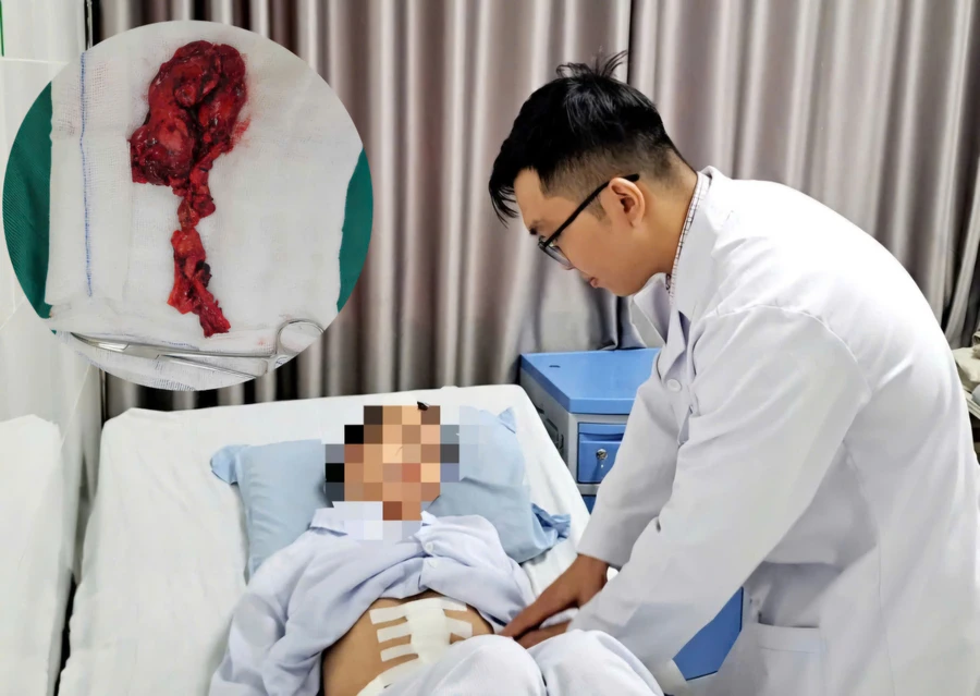 Sức khỏe bệnh nhân ổn định sau phẫu thuật. (Ảnh: BVCC)