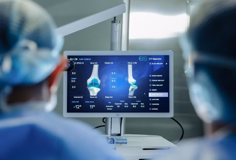 Phần mềm tích hợp AI chuyên dụng của Robot CUVIS-Joint giúp bác sĩ lập kế hoạch mổ và dễ dàng tinh chỉnh kế hoạch mổ với hình ảnh 3D.